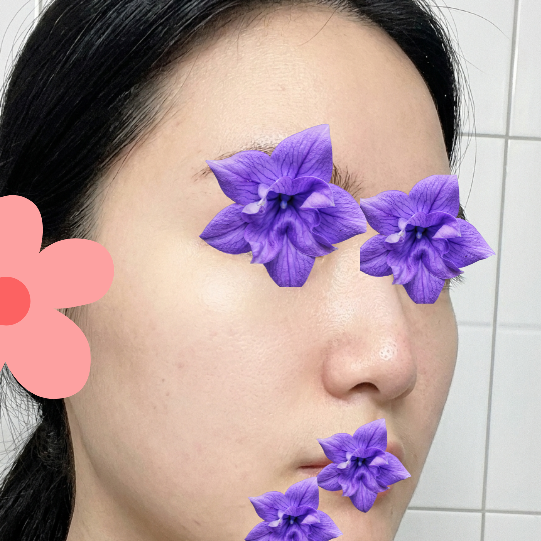 수술후기이미지