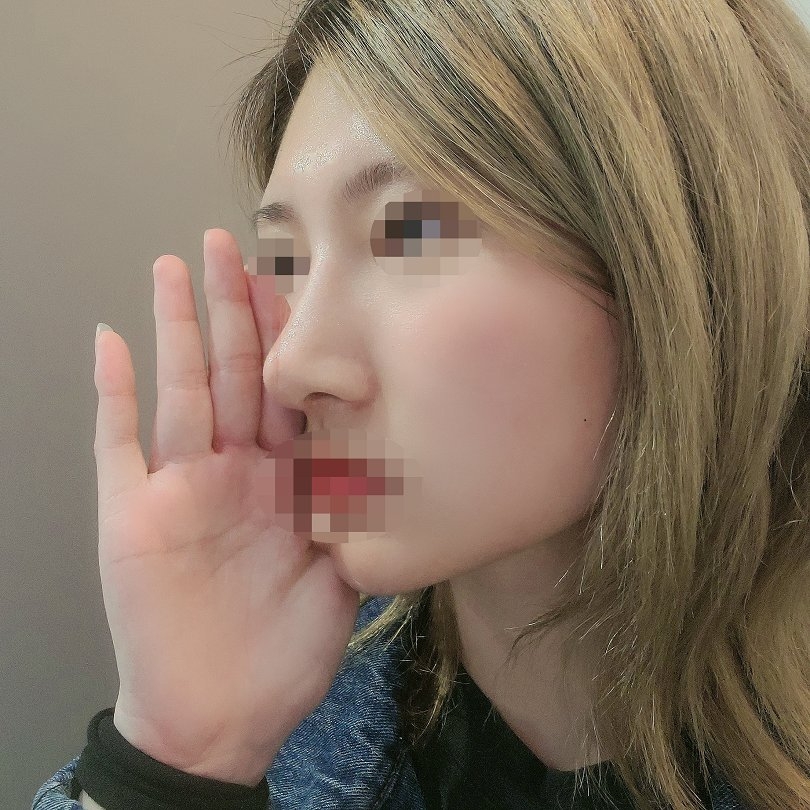 수술후기이미지