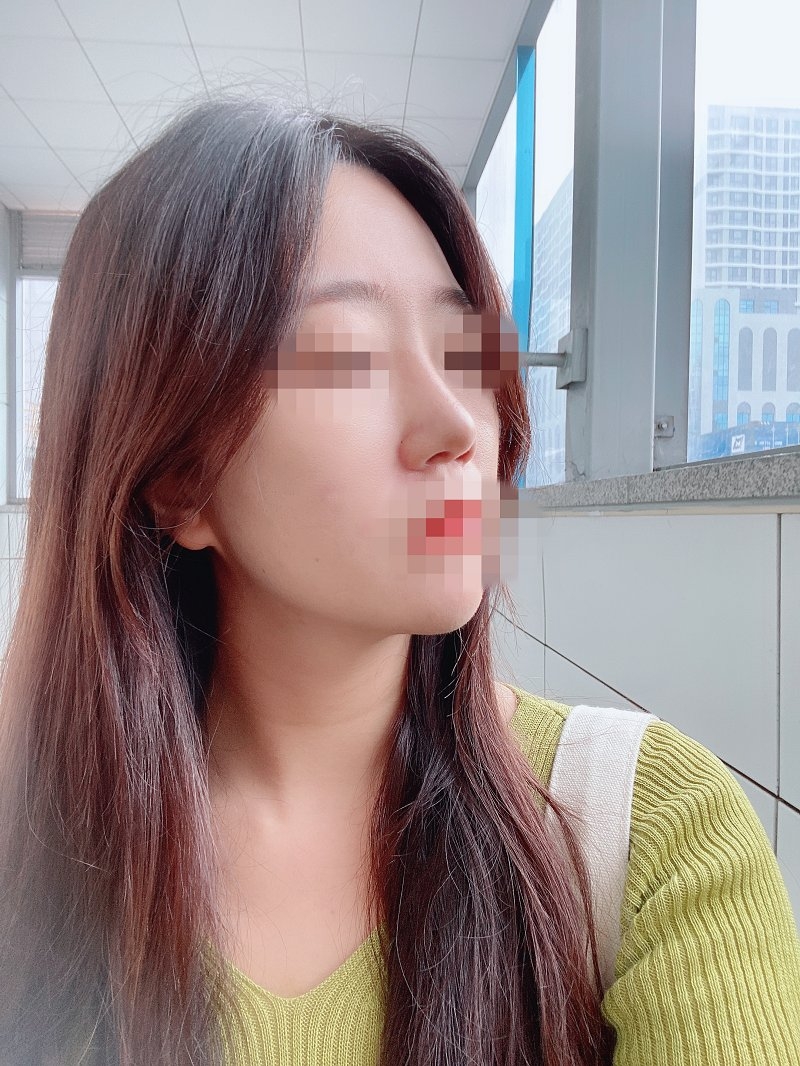 수술후기이미지