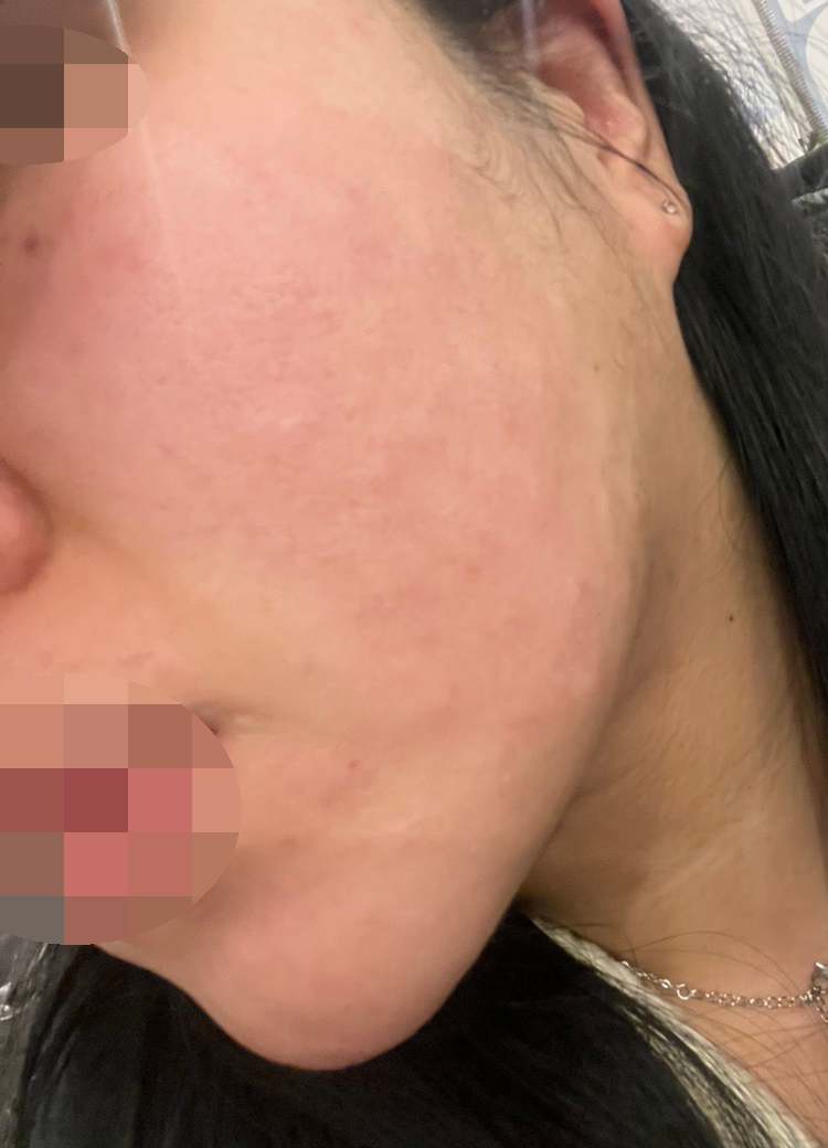 수술후기이미지