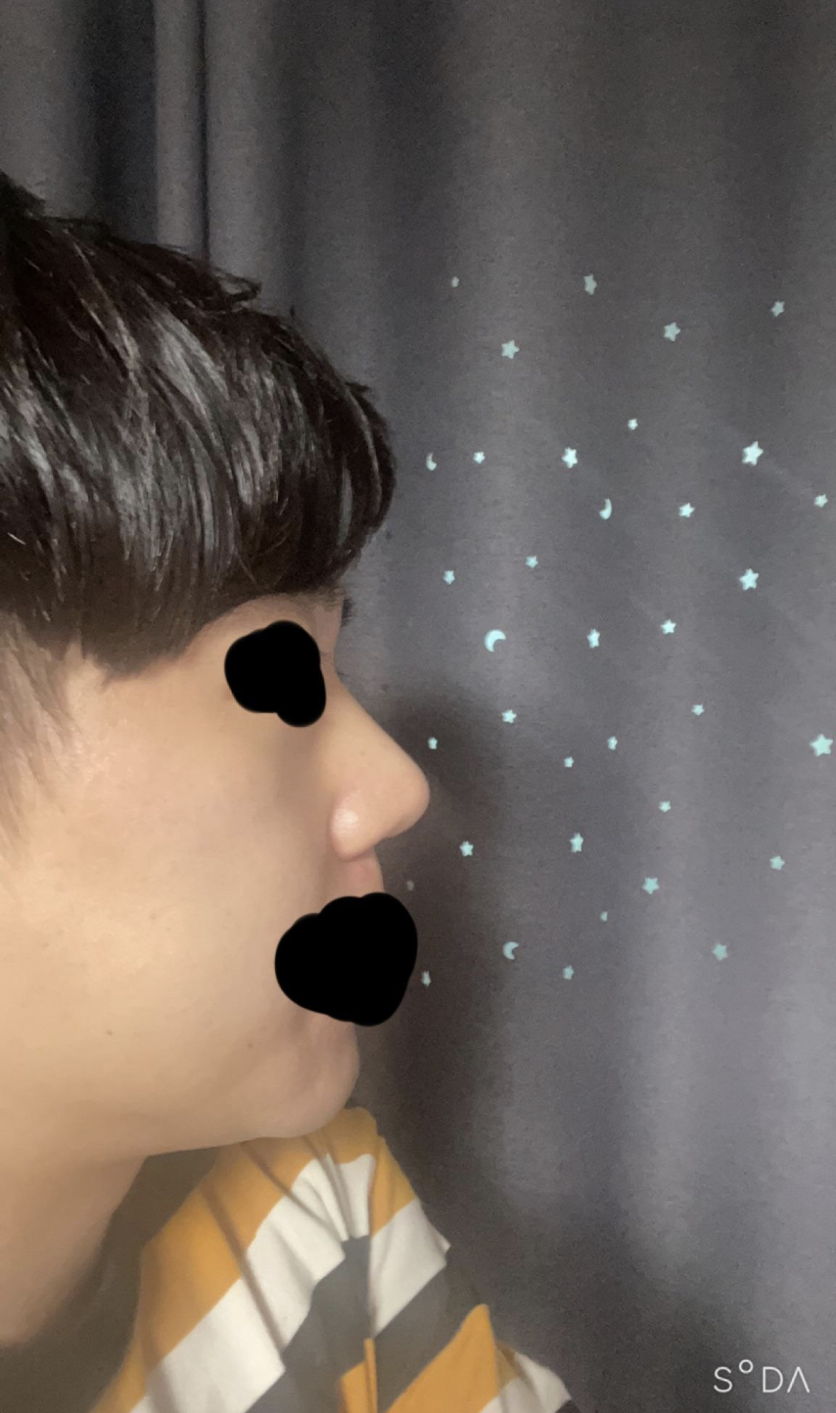 수술후기이미지