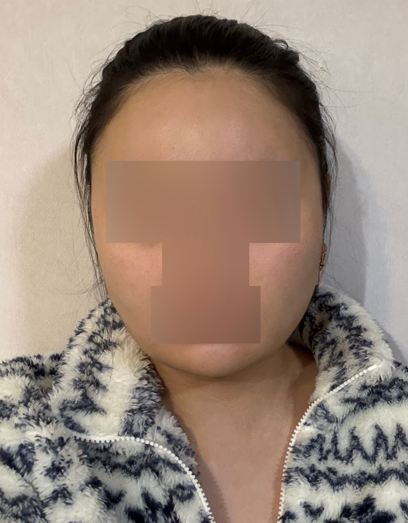수술후기이미지