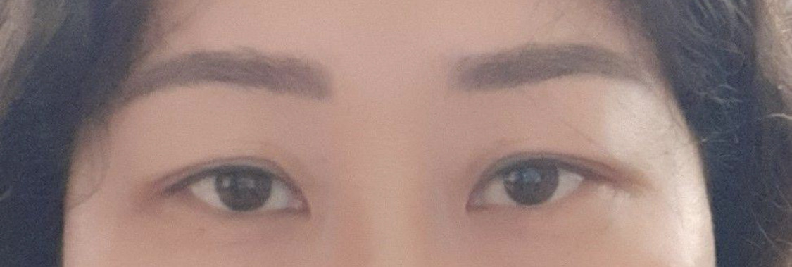 수술후기이미지