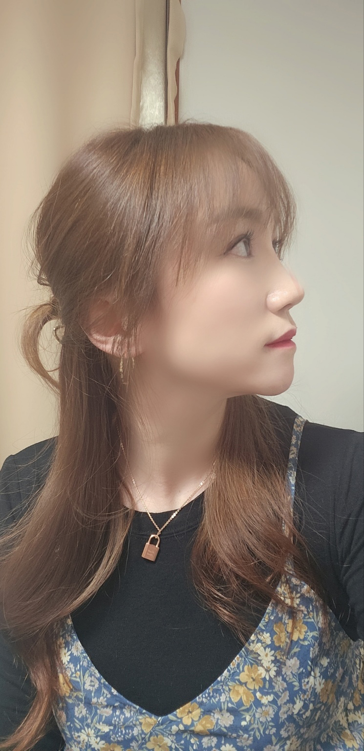 수술후기이미지