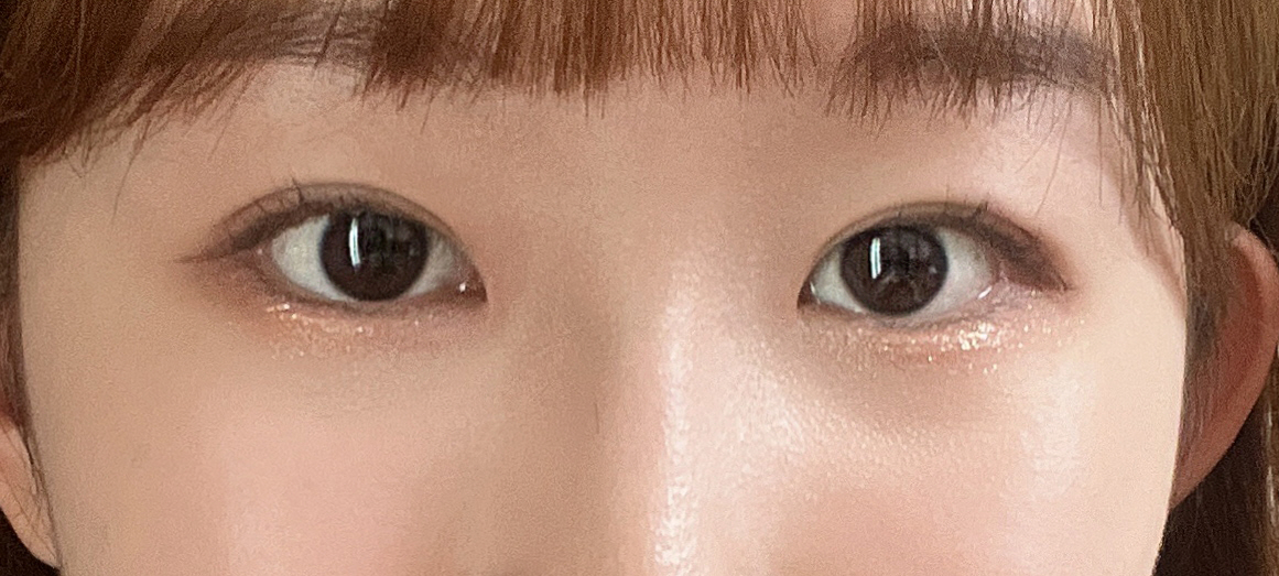 수술후기이미지