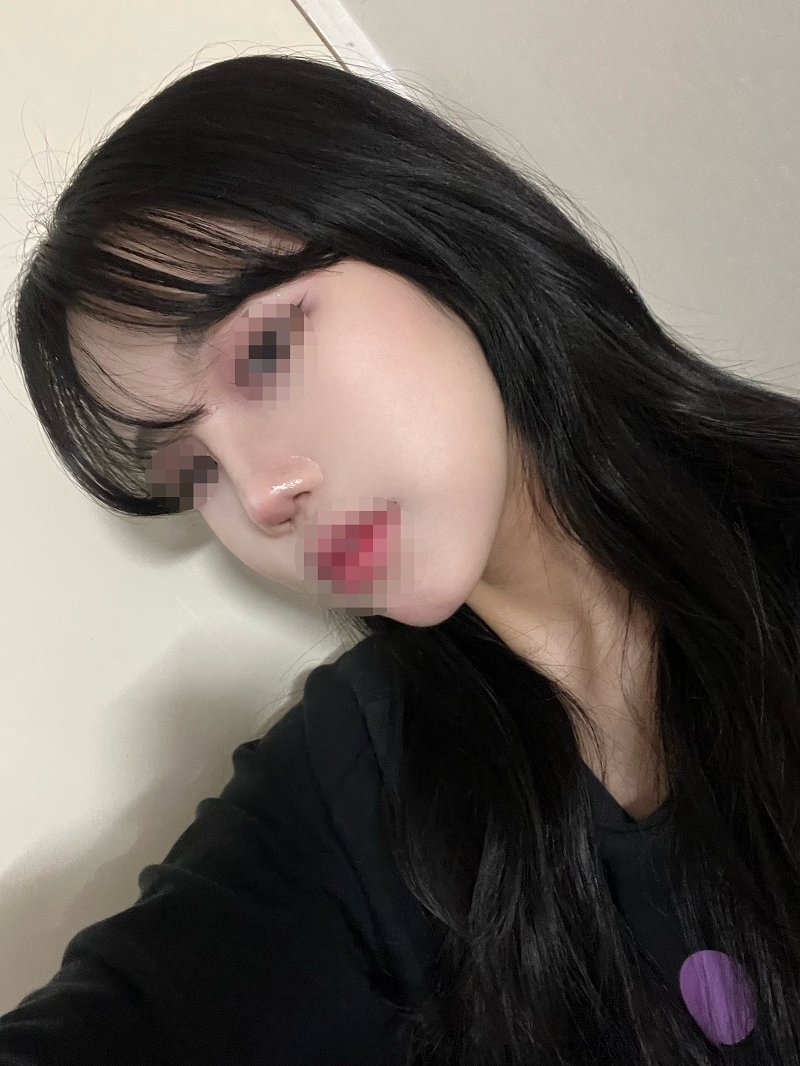 수술후기이미지