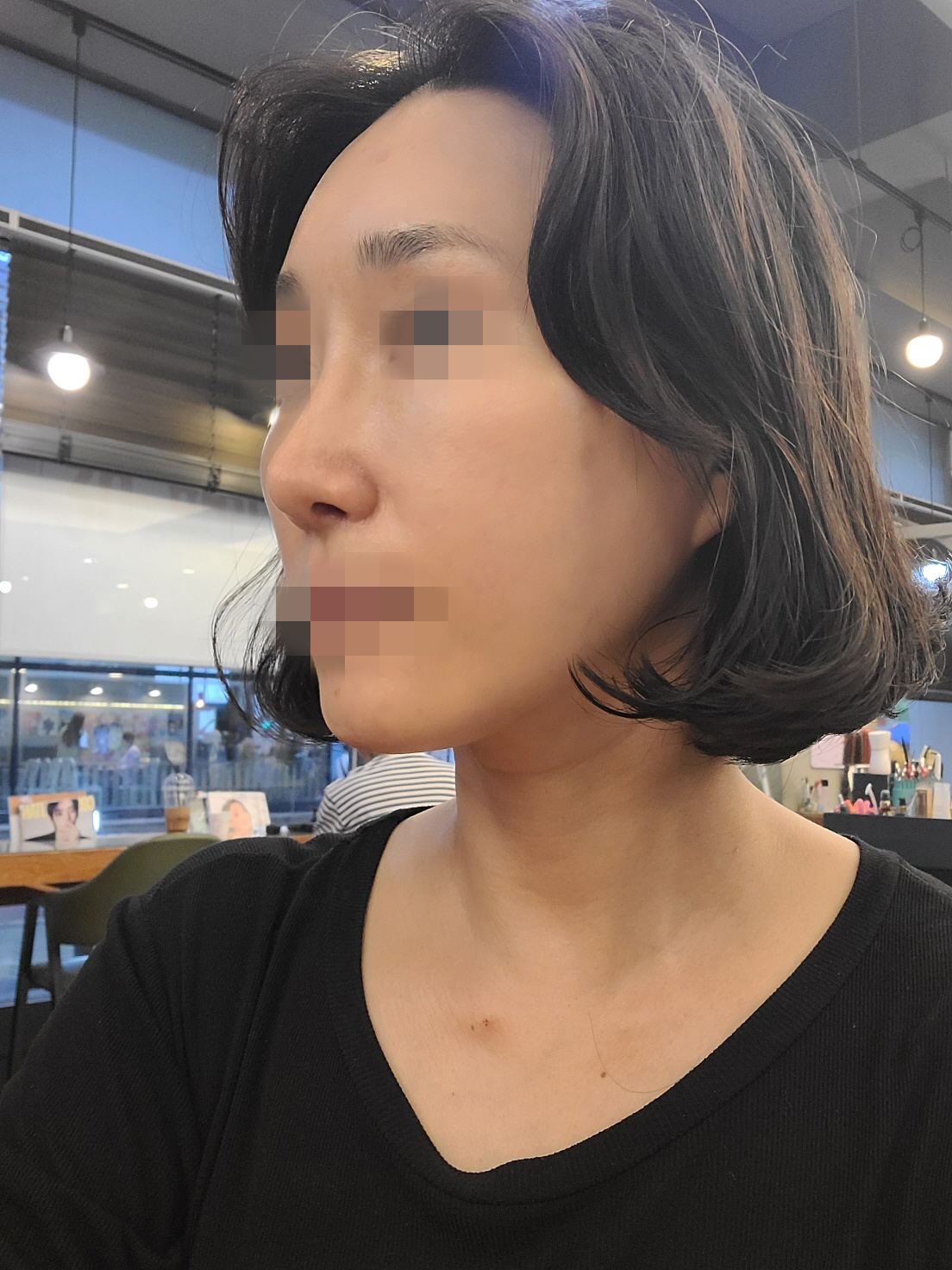 수술후기이미지