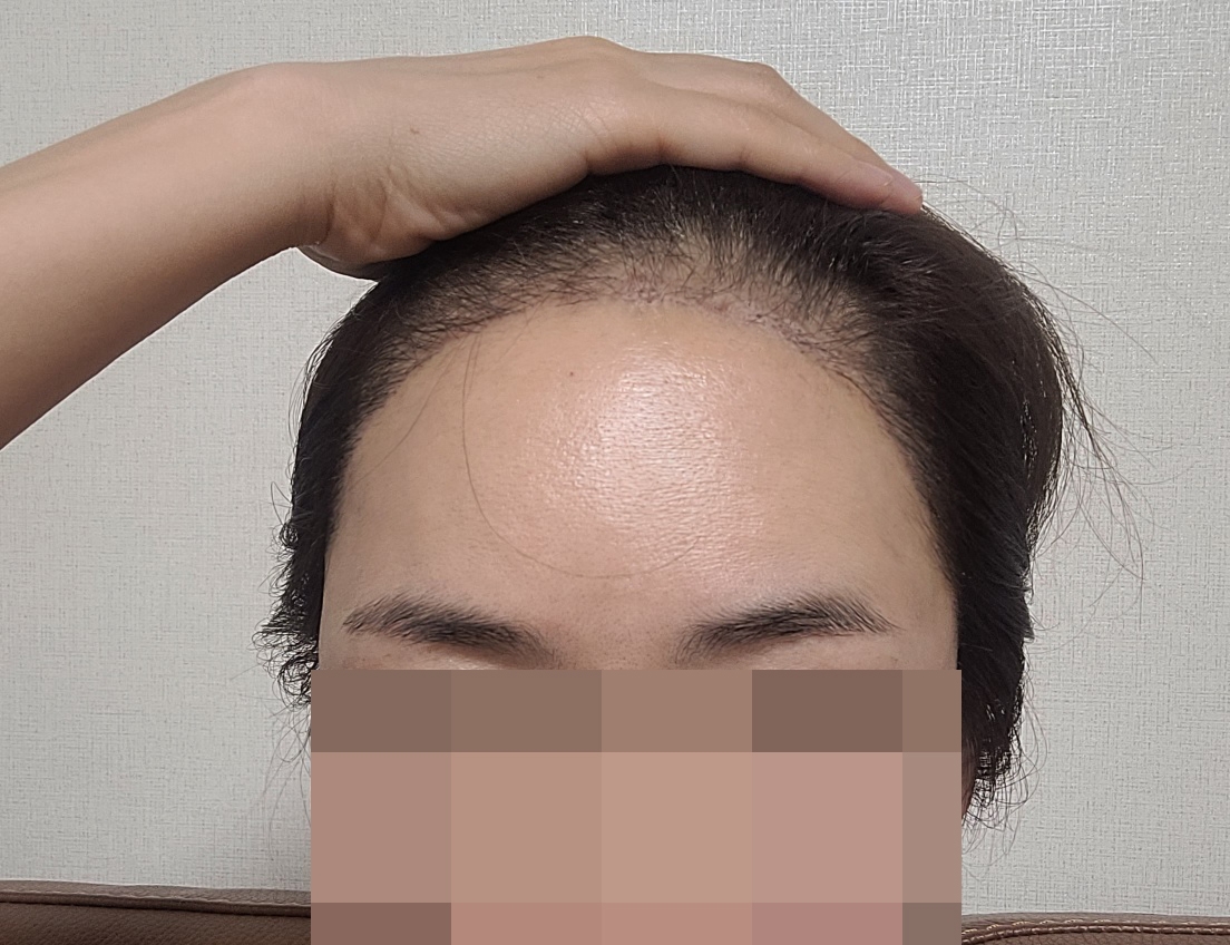 수술후기이미지