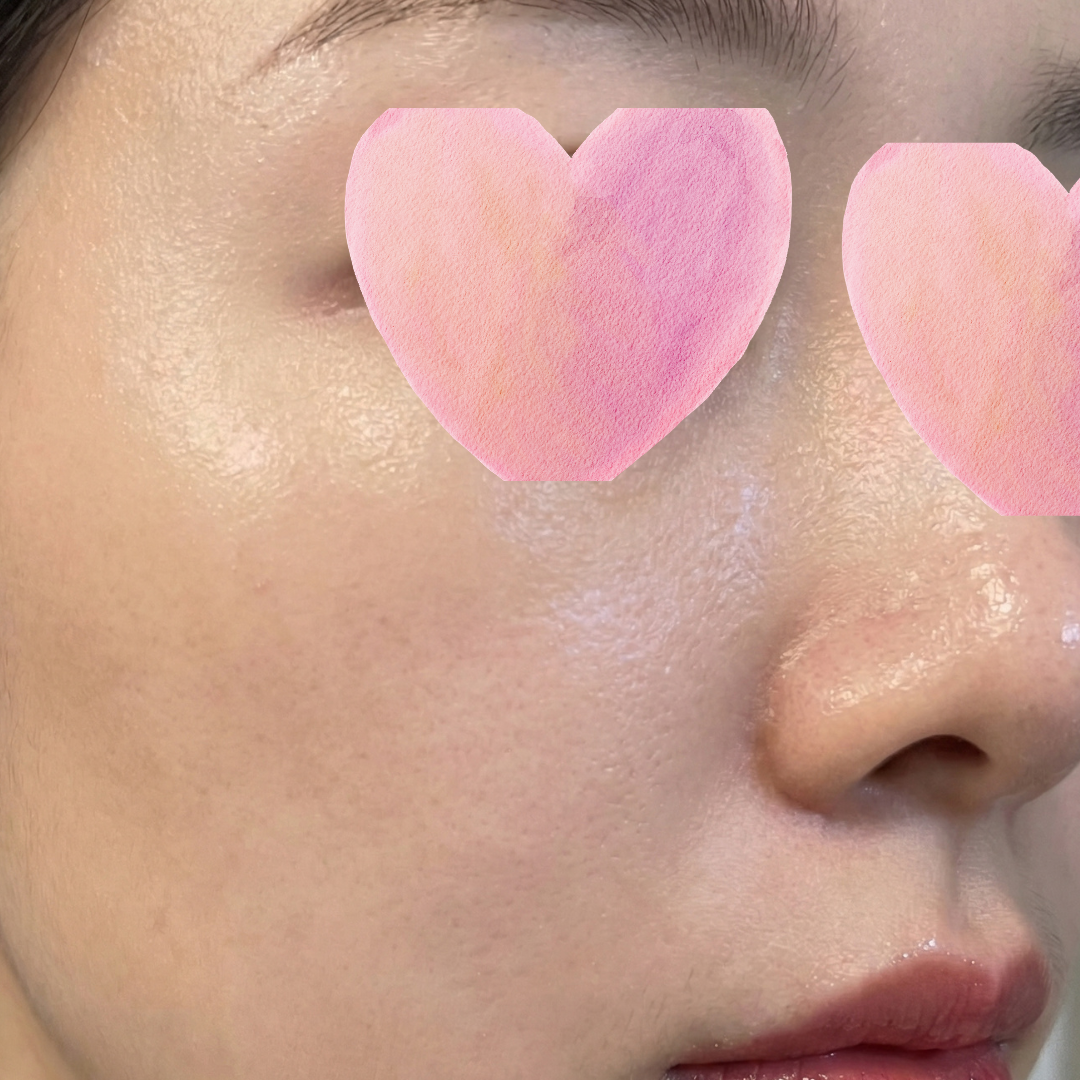 수술후기이미지