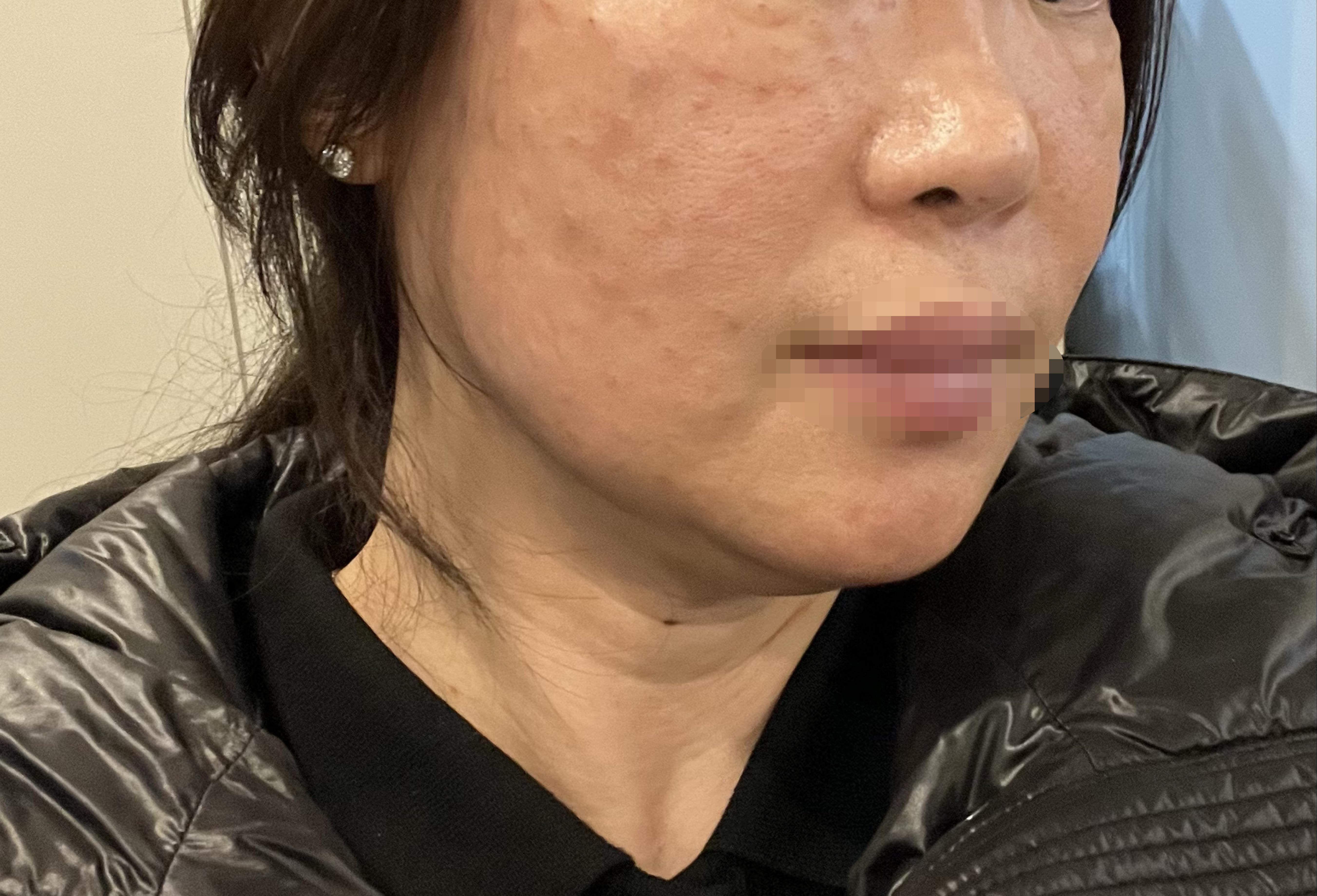 수술후기이미지