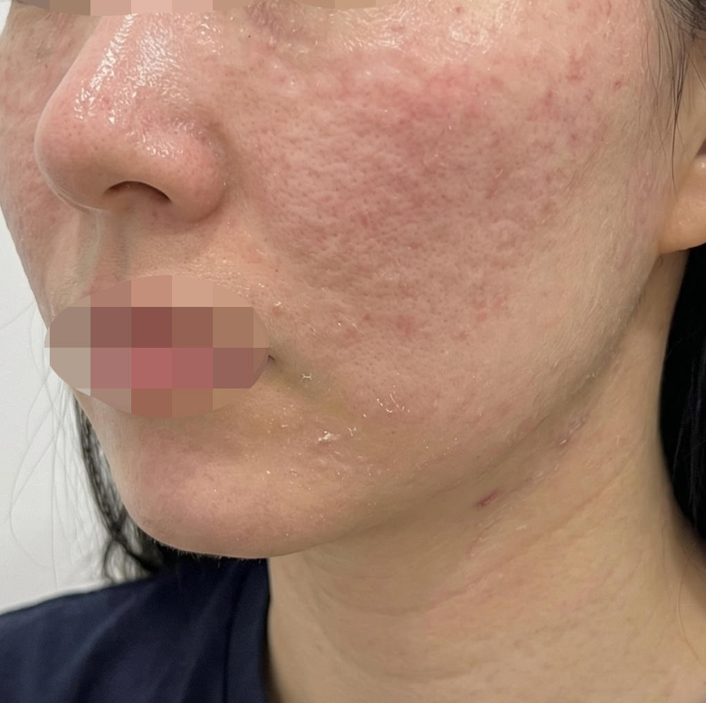 수술후기이미지