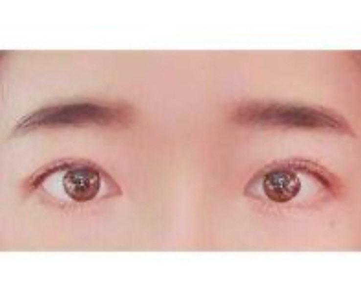 수술후기이미지