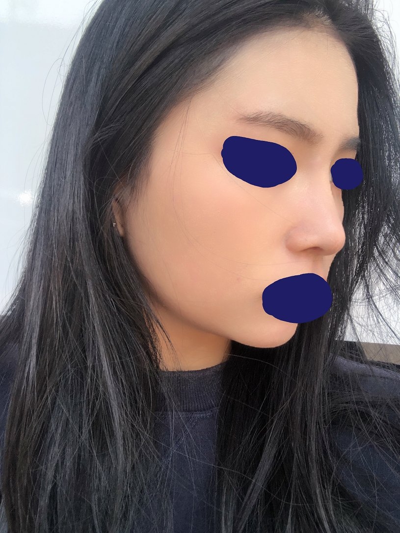 수술후기이미지