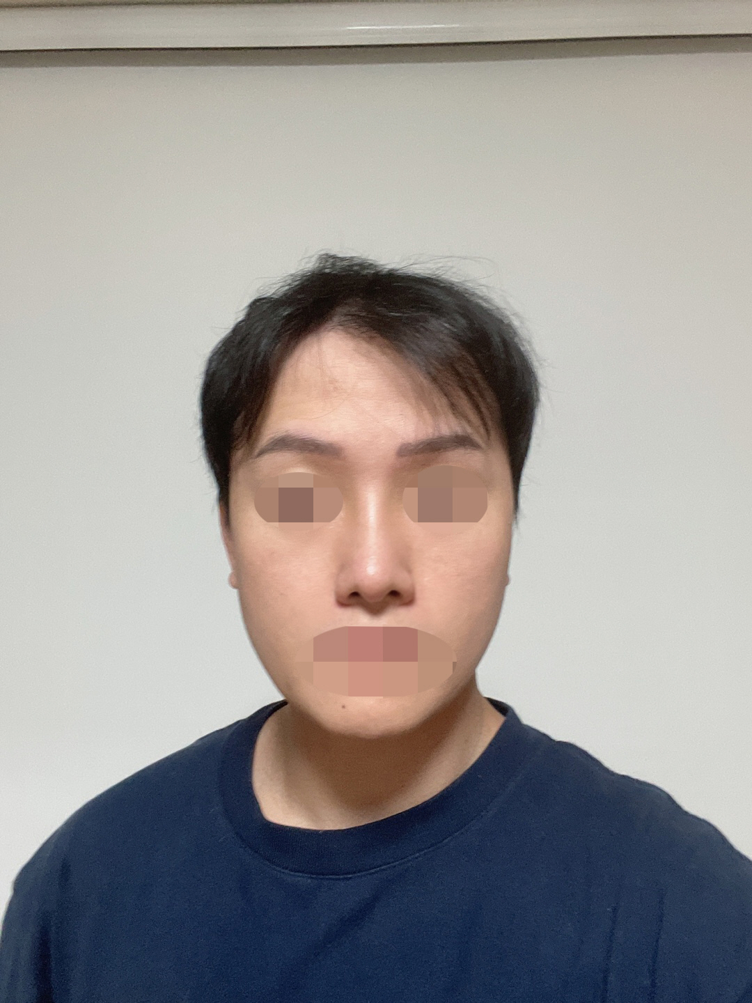 수술후기이미지