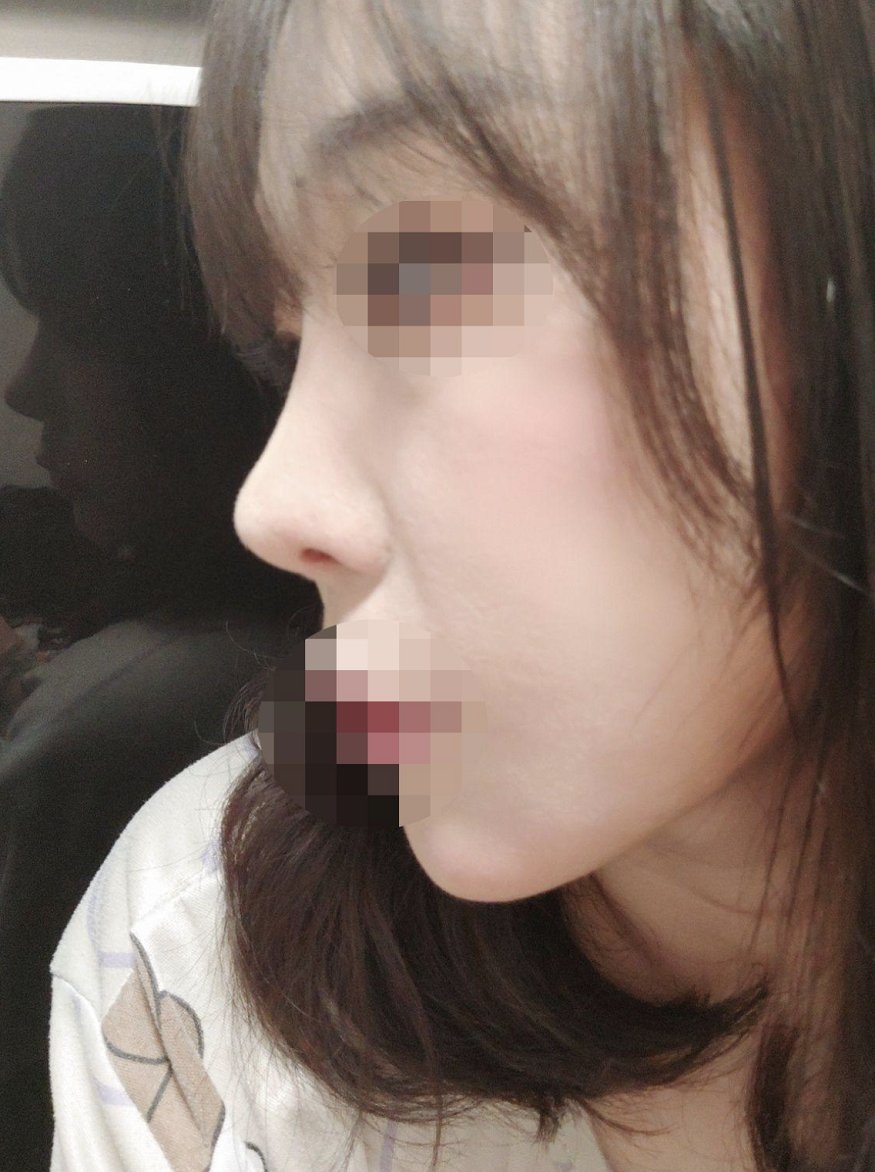 수술후기이미지