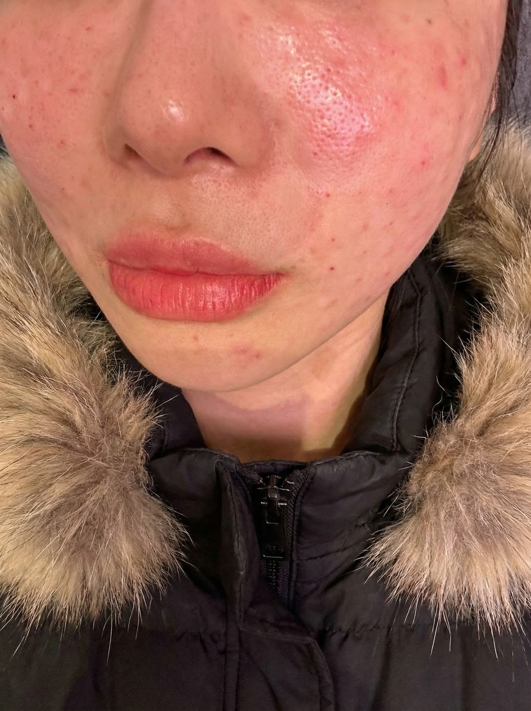 수술후기이미지