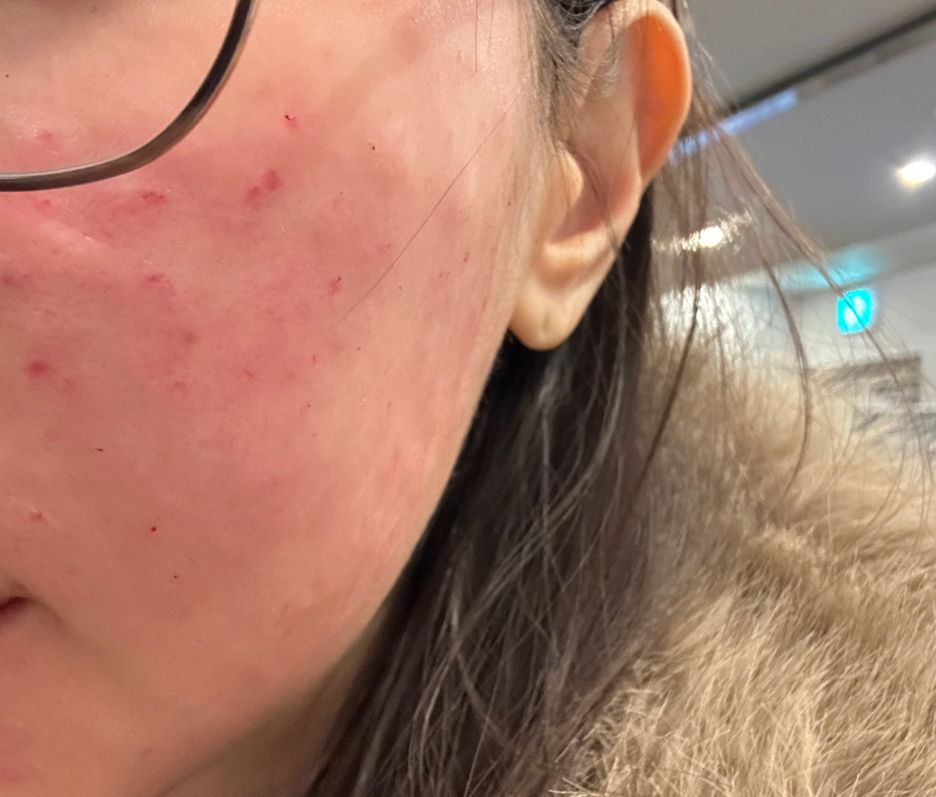 수술후기이미지