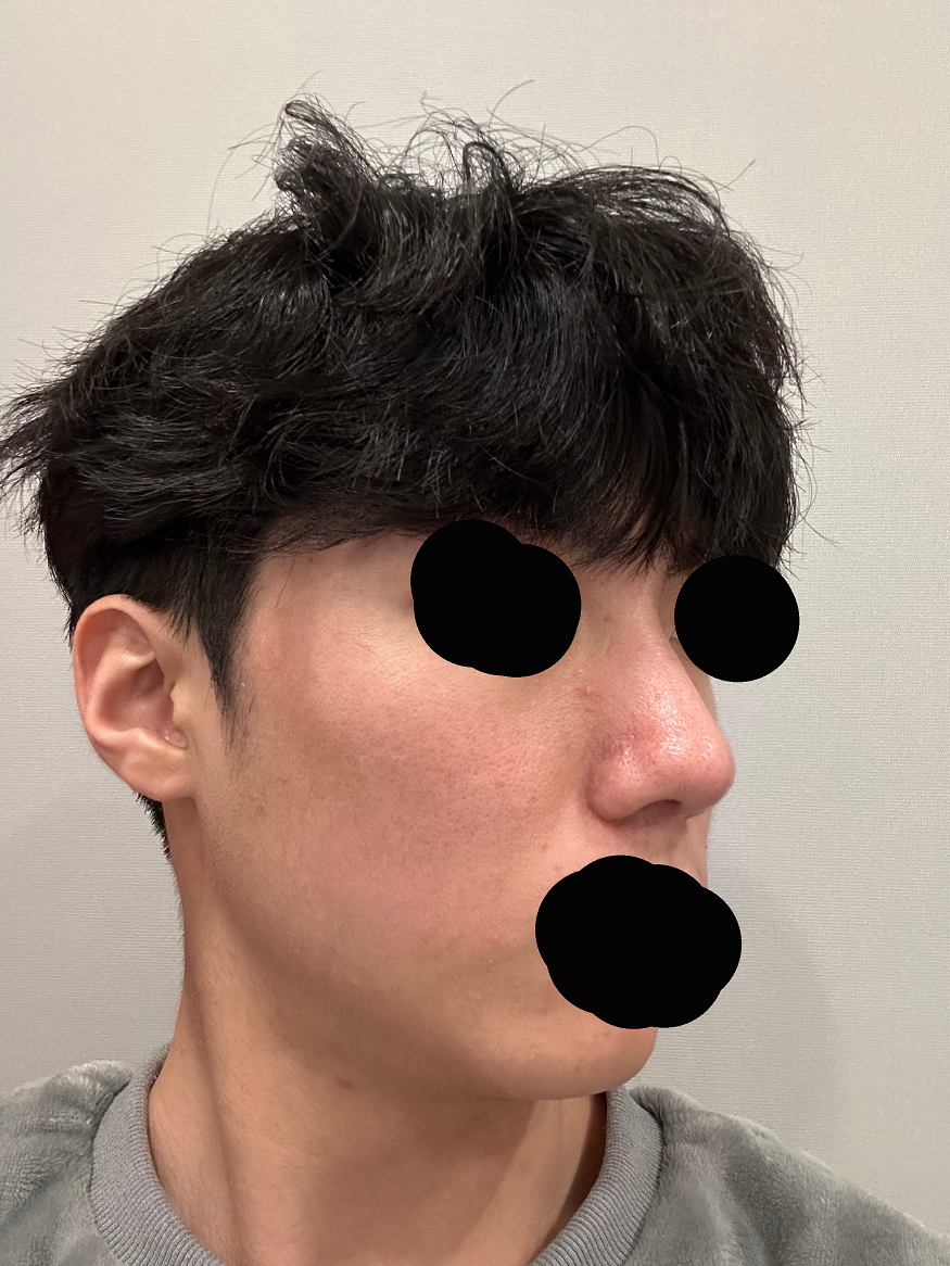 수술후기이미지