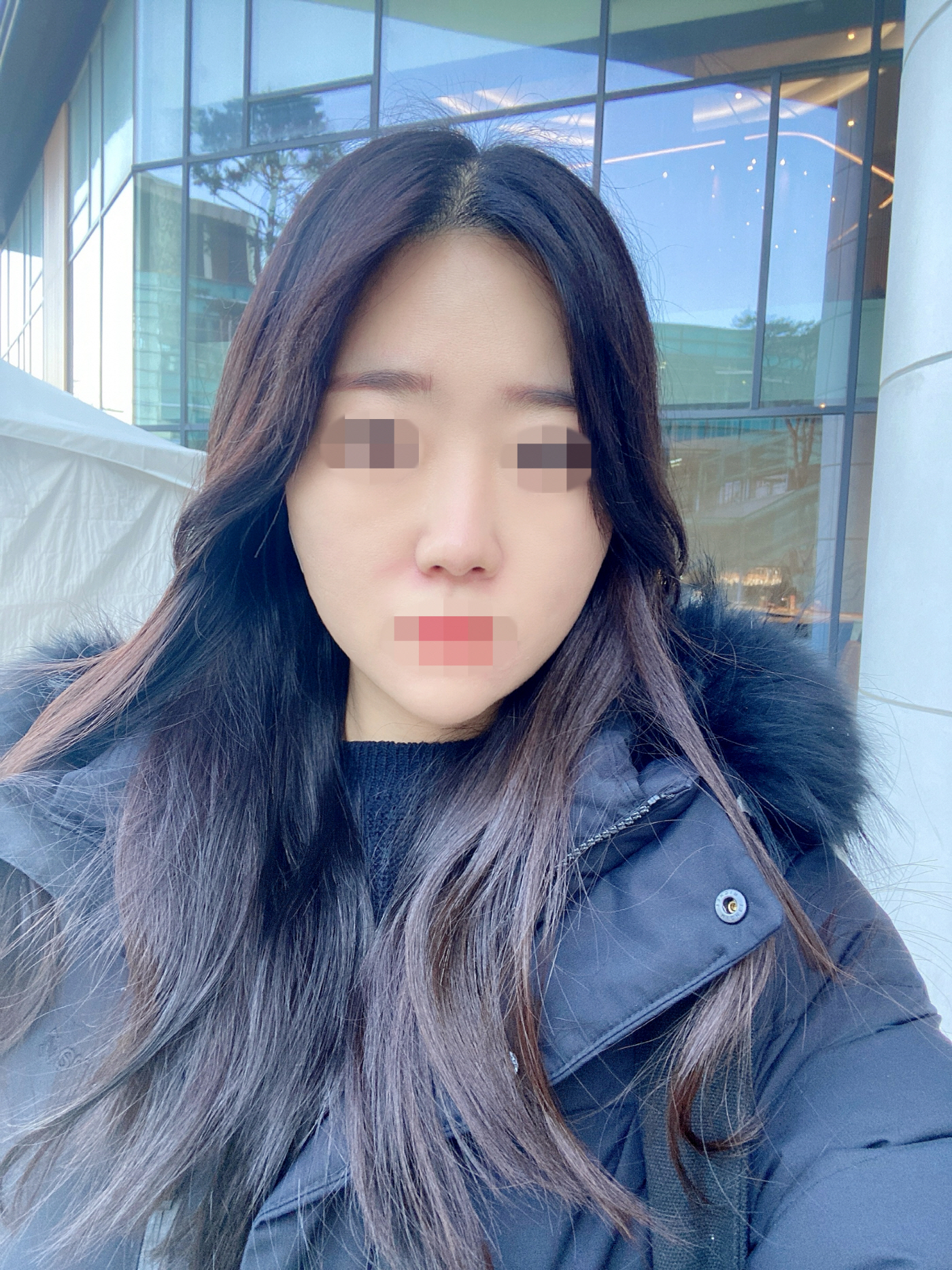 수술후기이미지