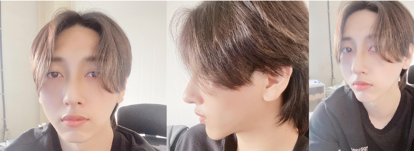 수술후기이미지