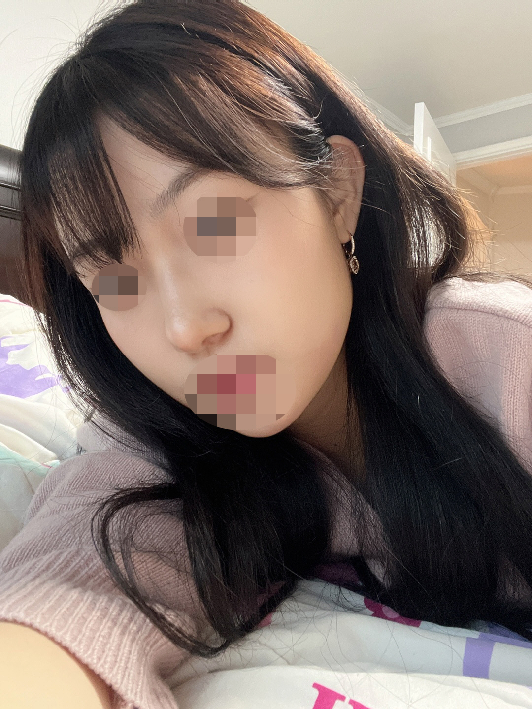 수술후기이미지