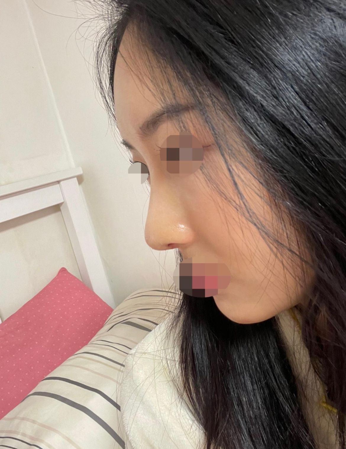 수술후기이미지