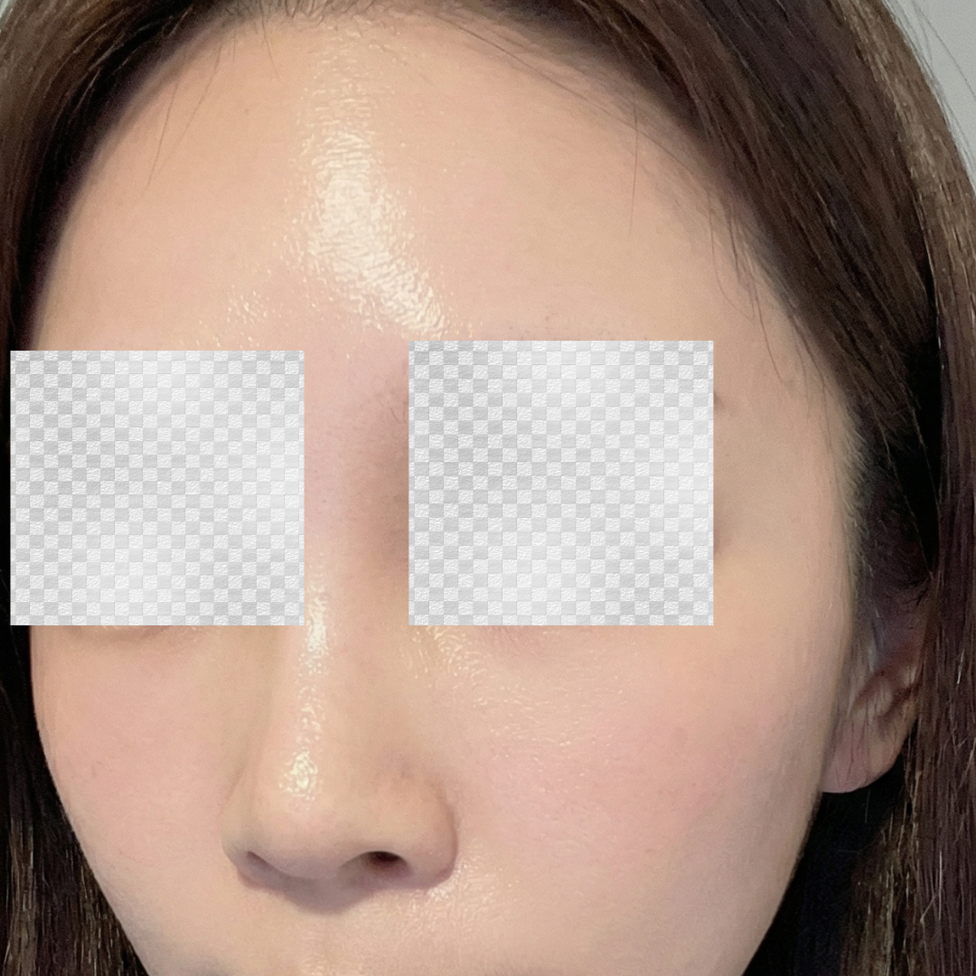 수술후기이미지