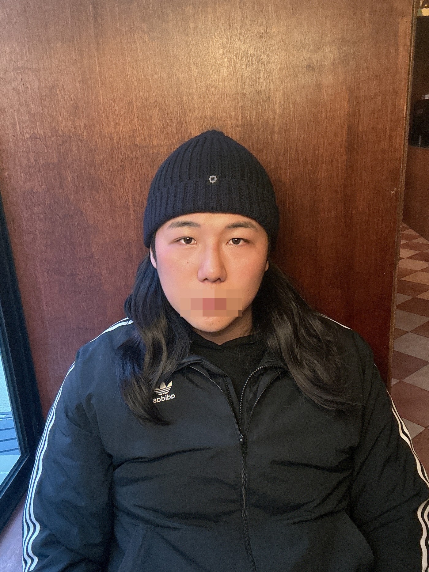 수술후기이미지