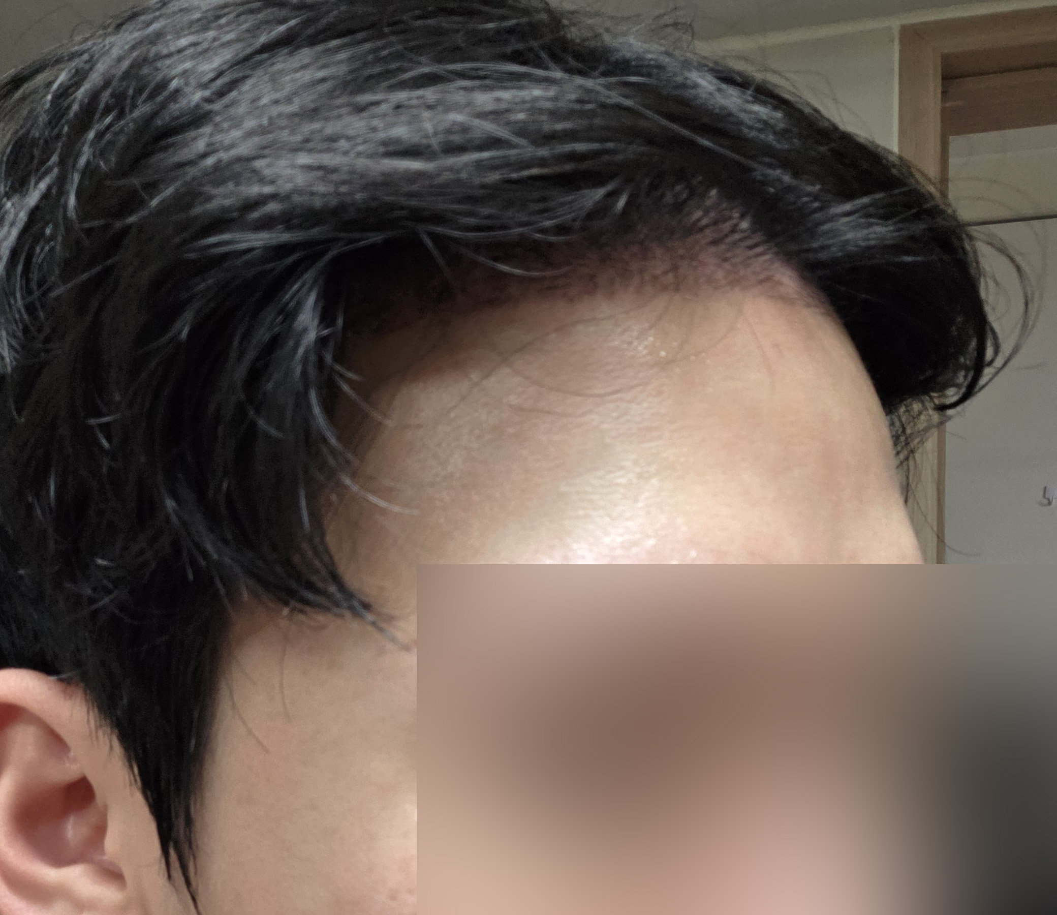 수술후기이미지