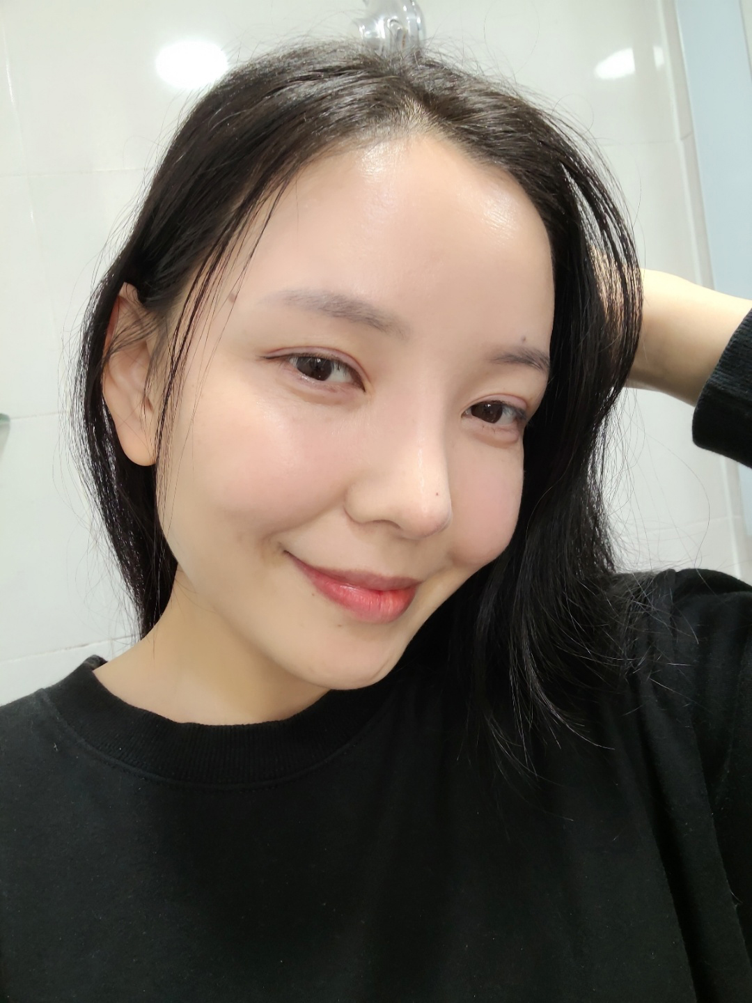 수술후기이미지