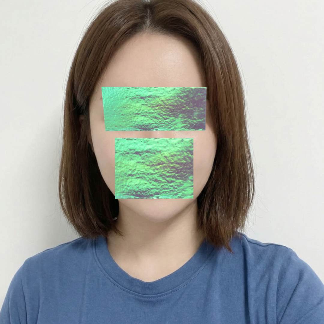 수술후기이미지