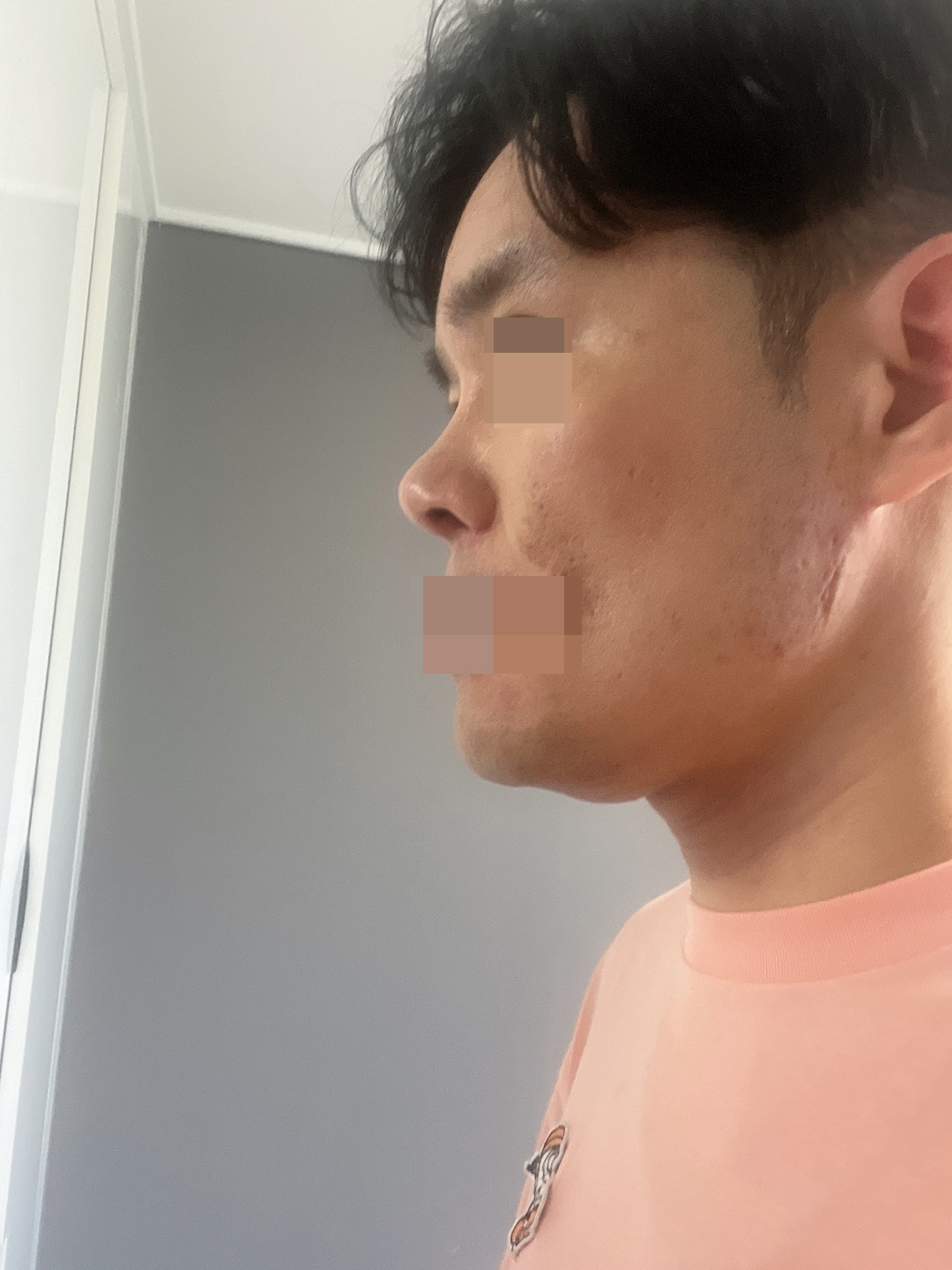 수술후기이미지