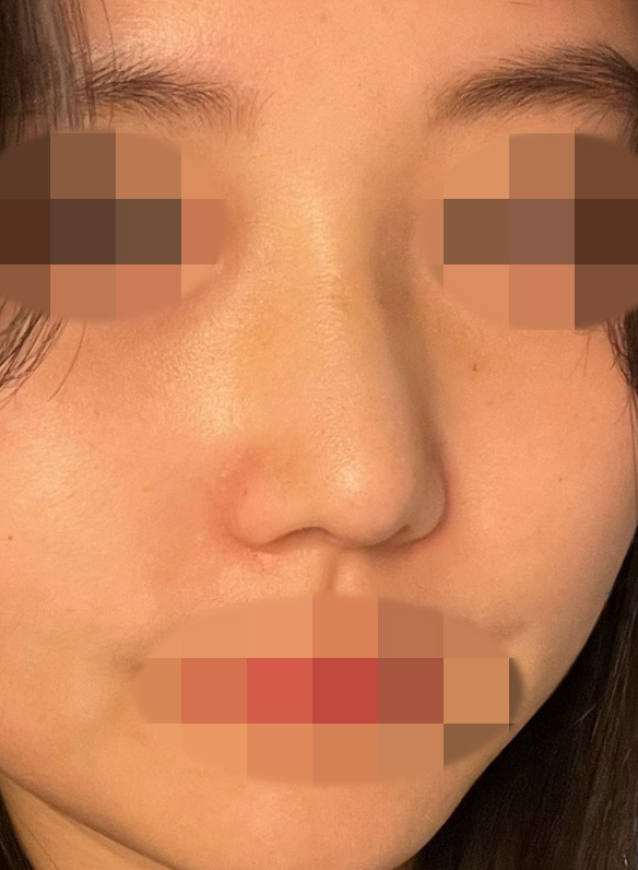 수술후기이미지