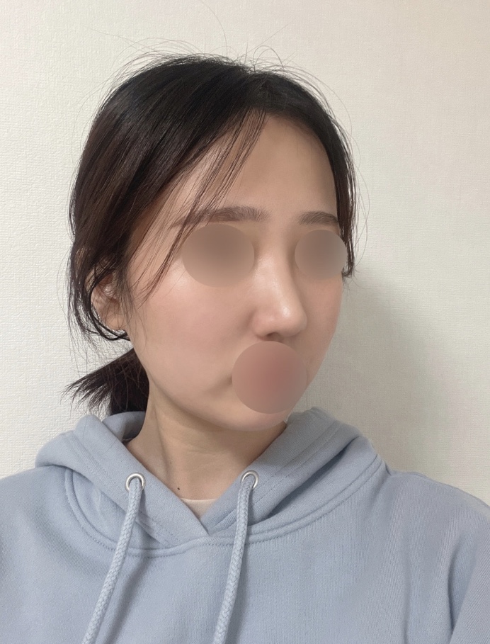 수술후기이미지