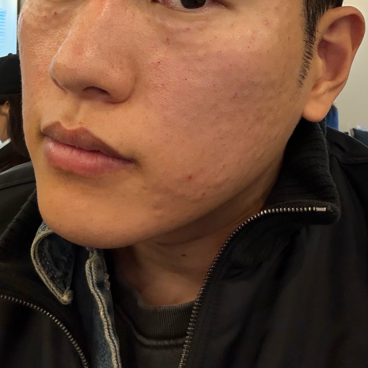 수술후기이미지