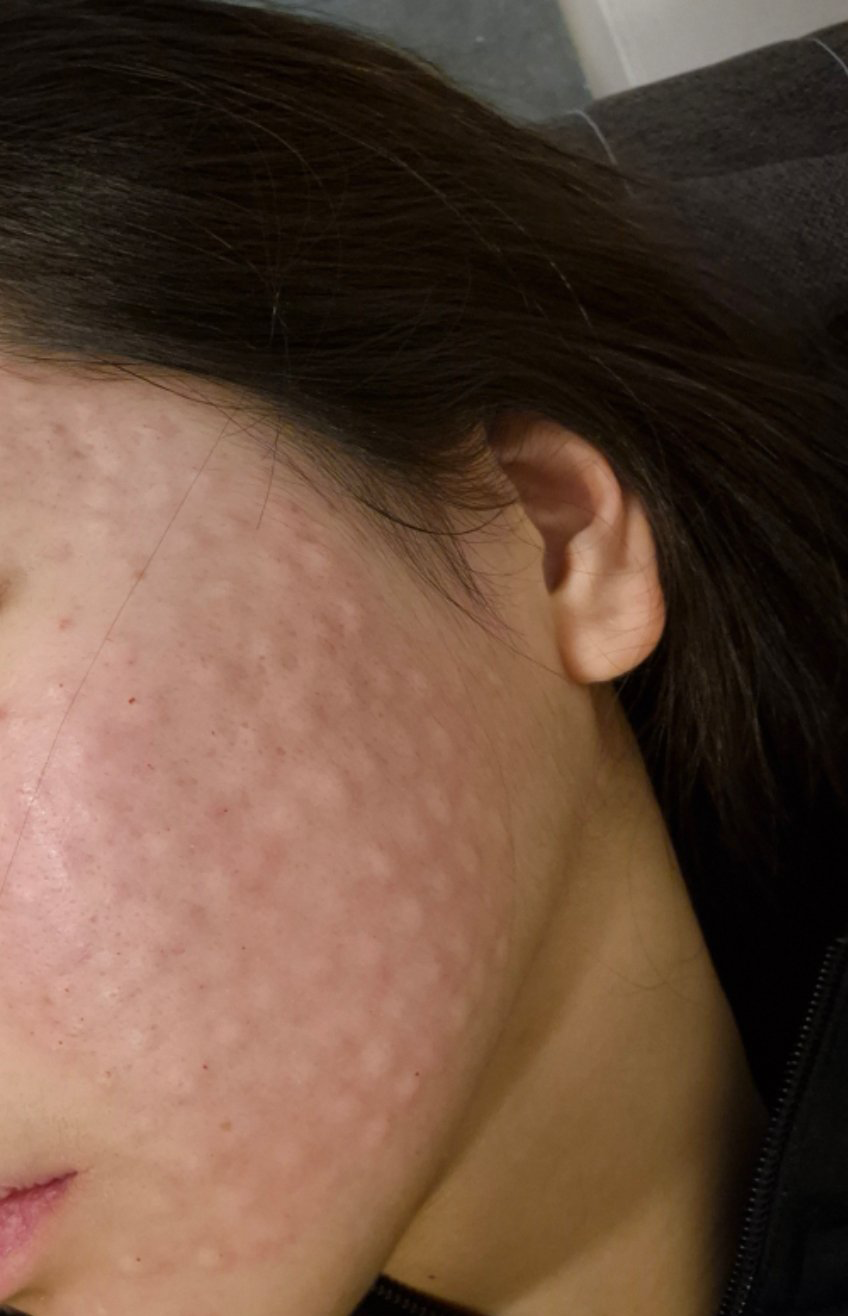 수술후기이미지