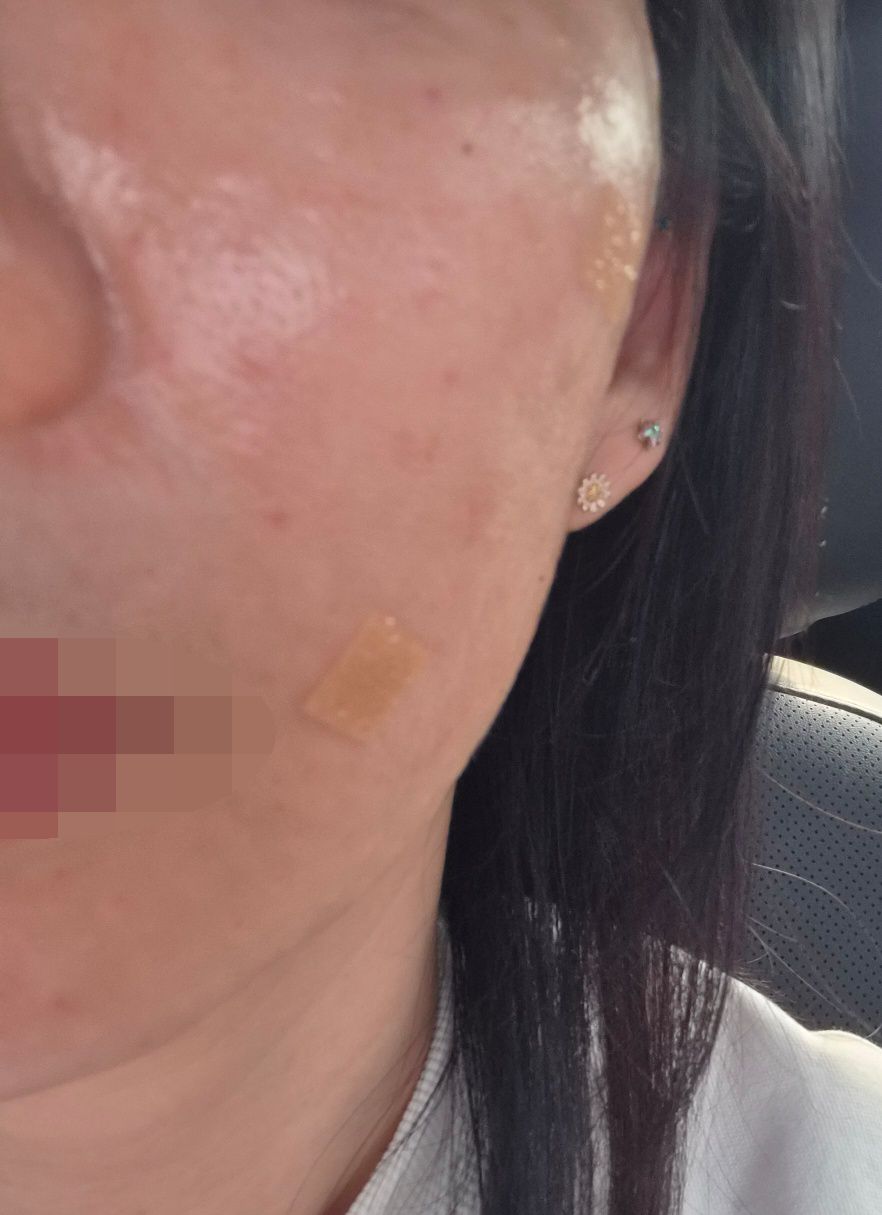 수술후기이미지