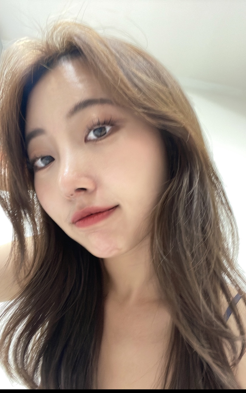 수술후기이미지