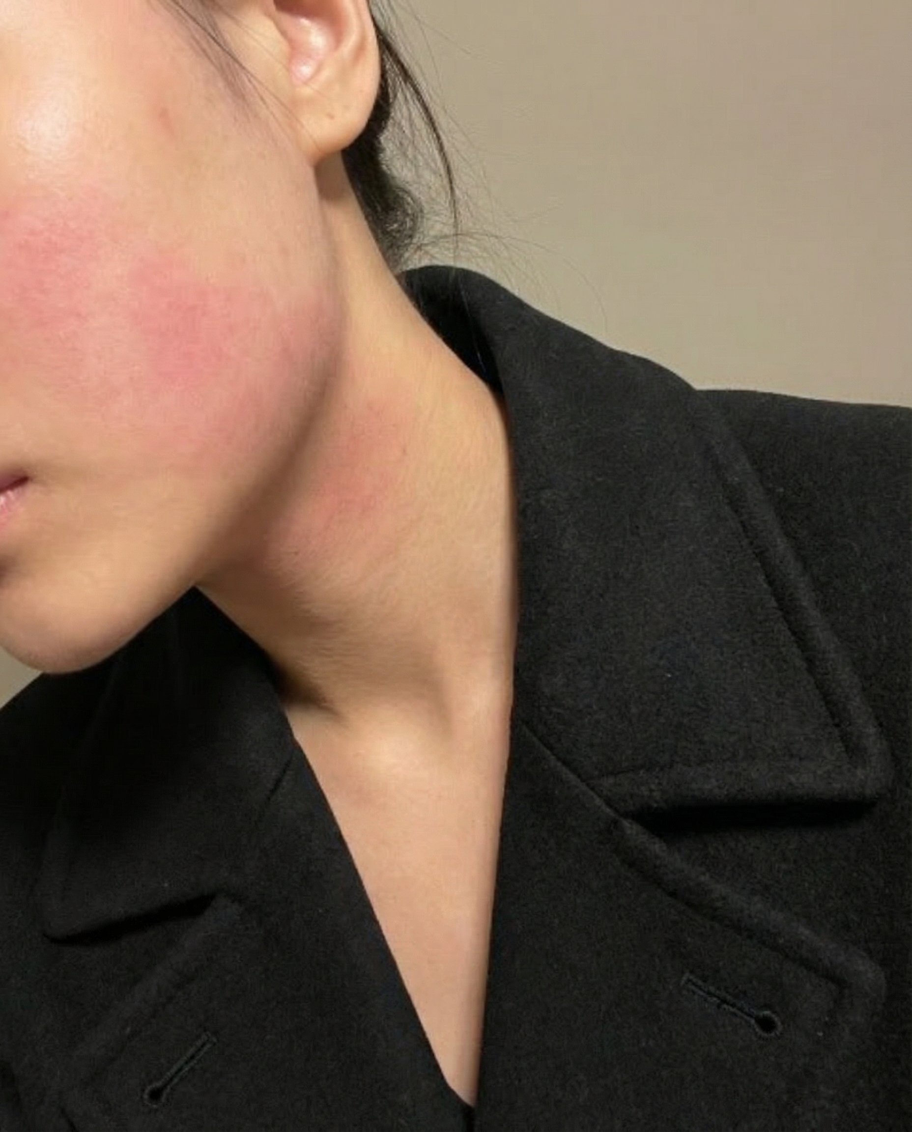 수술후기이미지