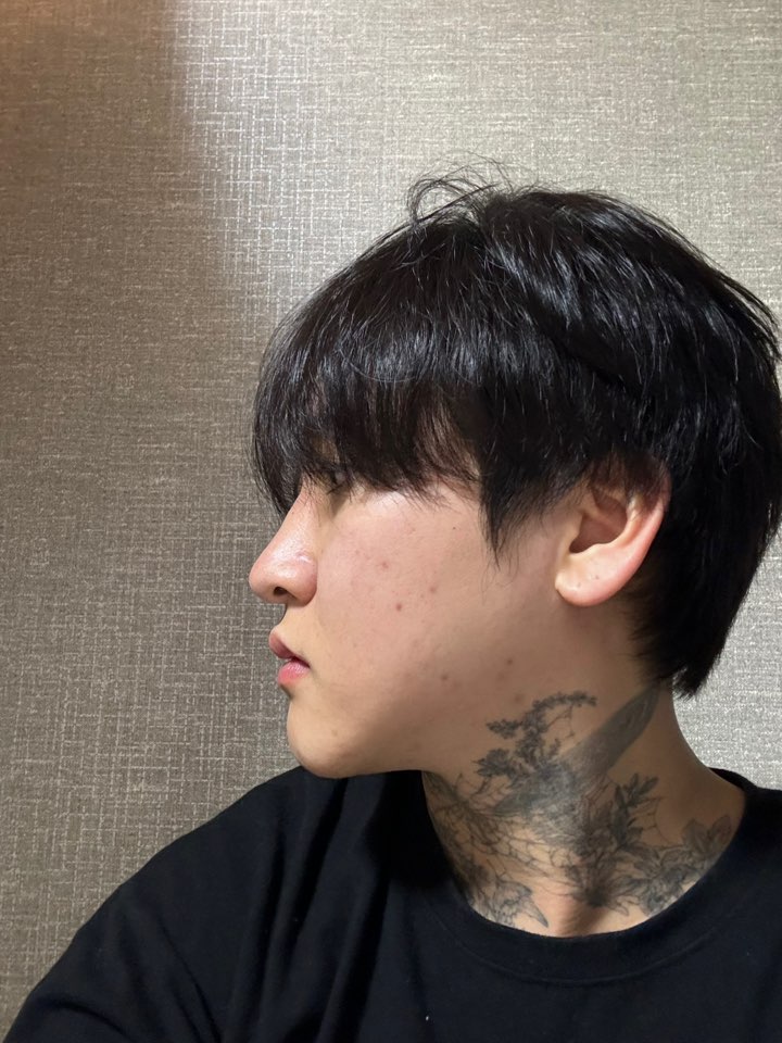 수술후기이미지