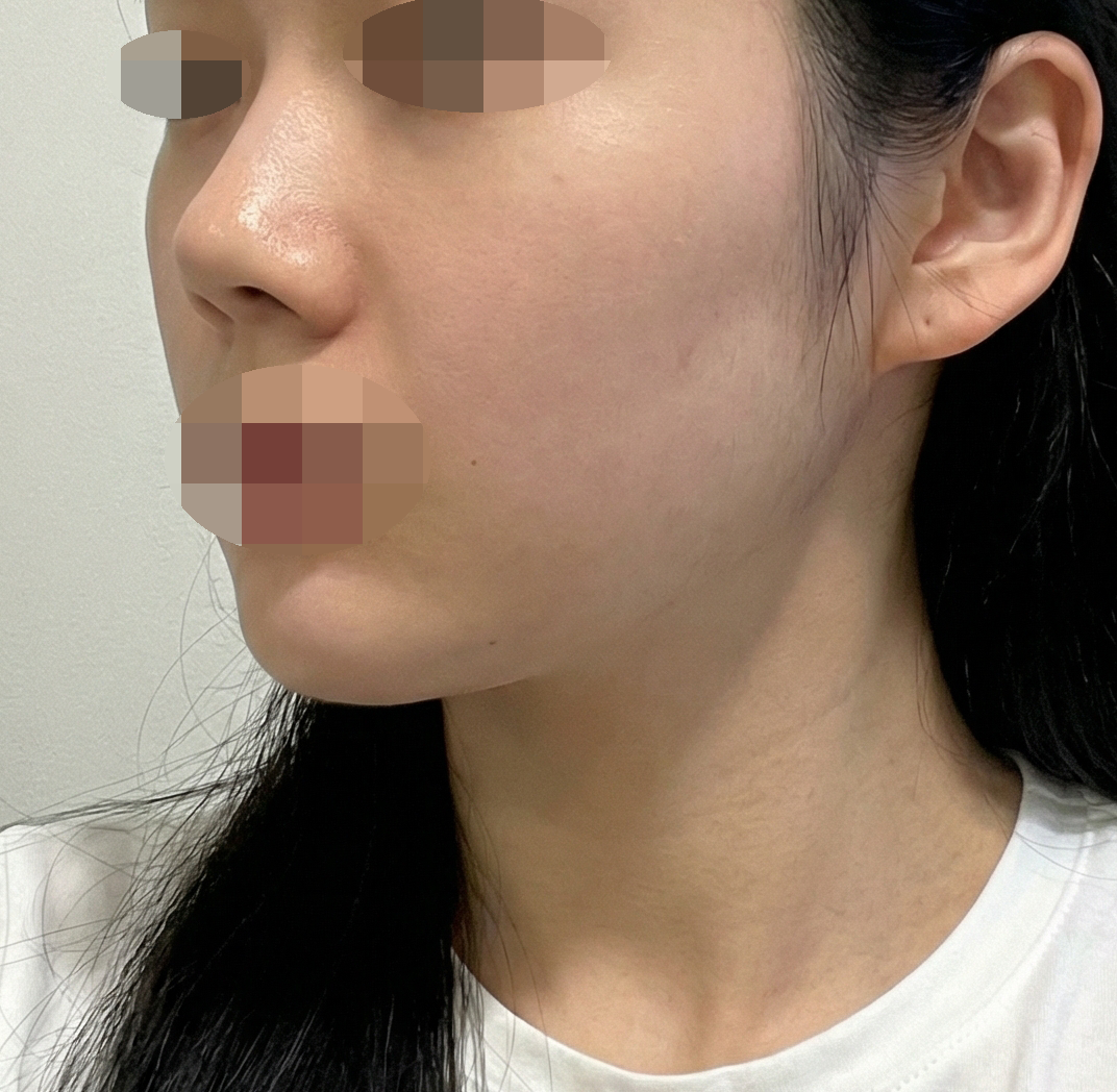 수술후기이미지