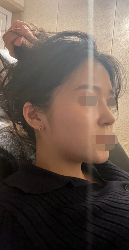 수술후기이미지