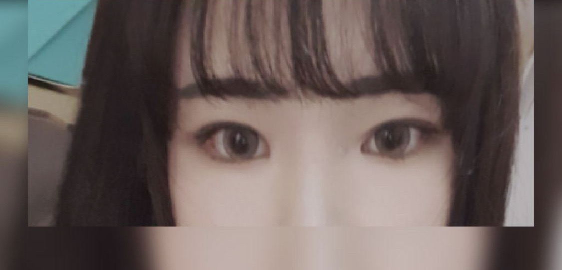 수술후기이미지