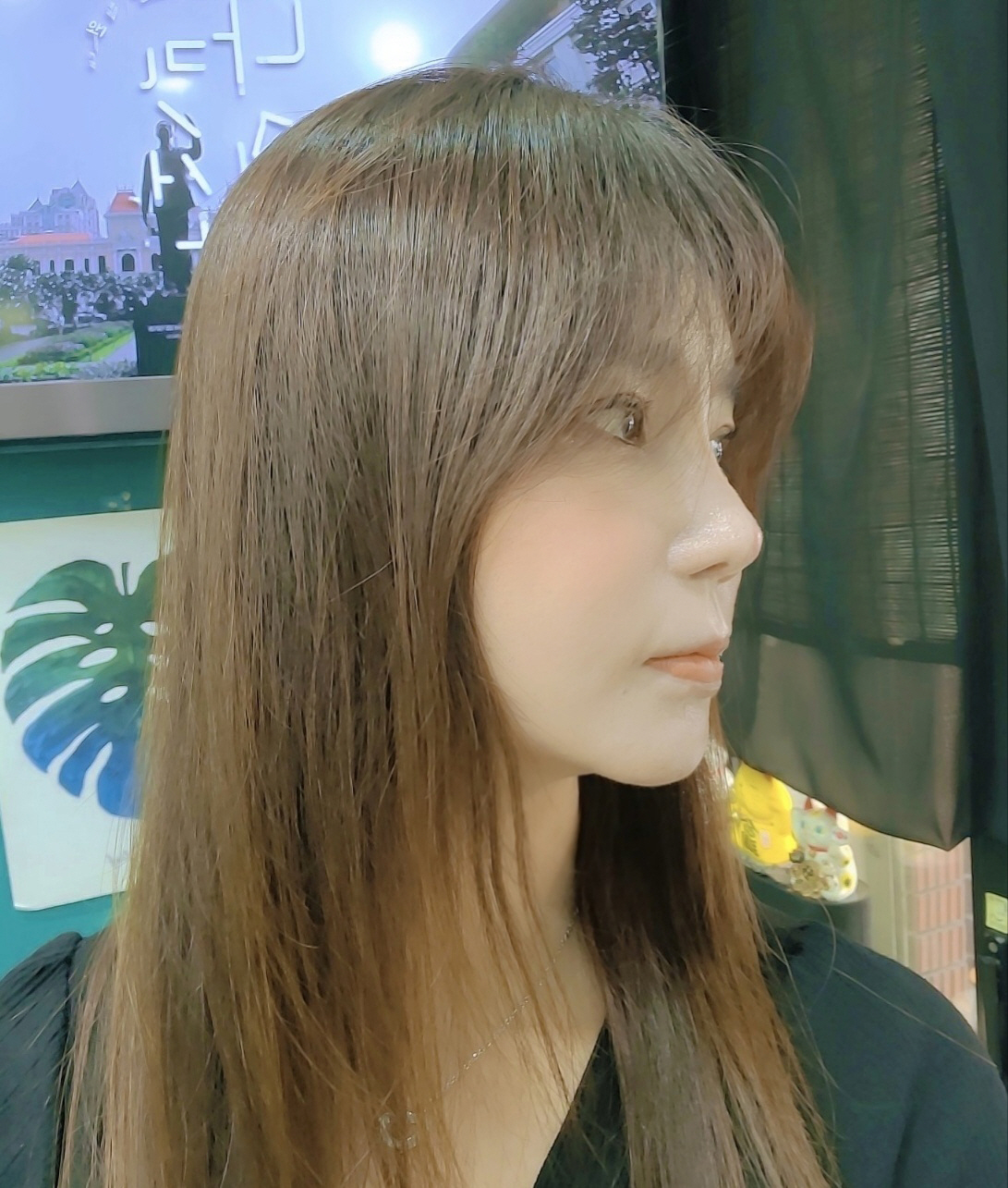 수술후기이미지