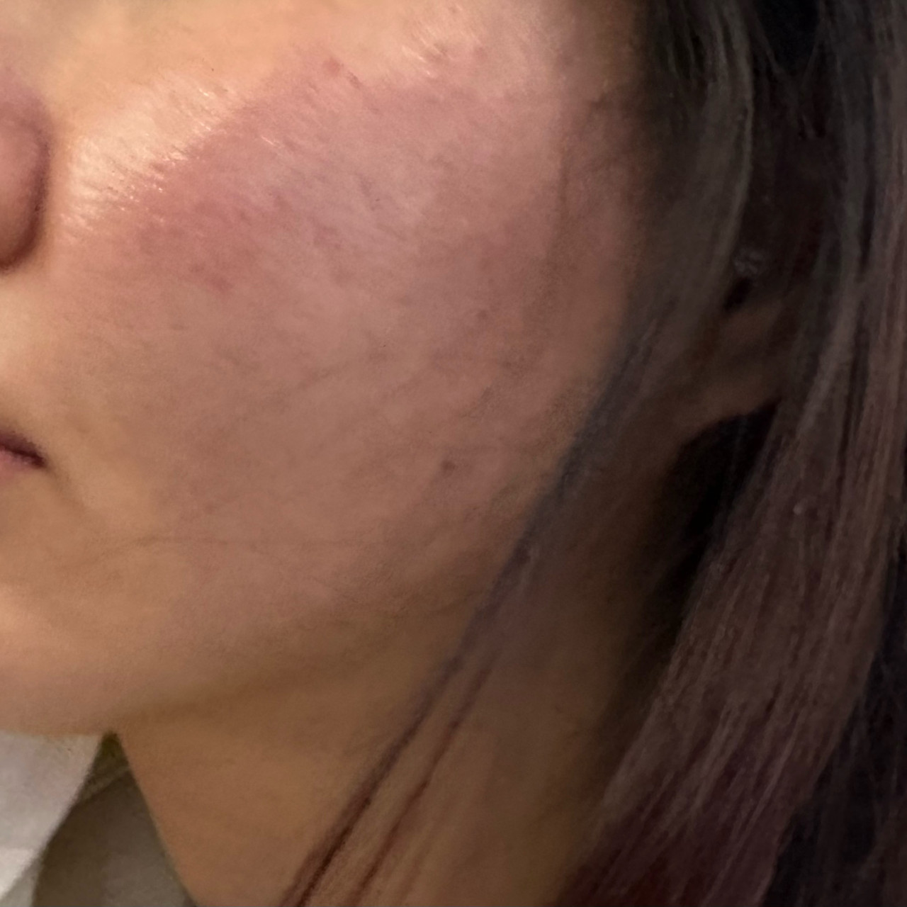 수술후기이미지