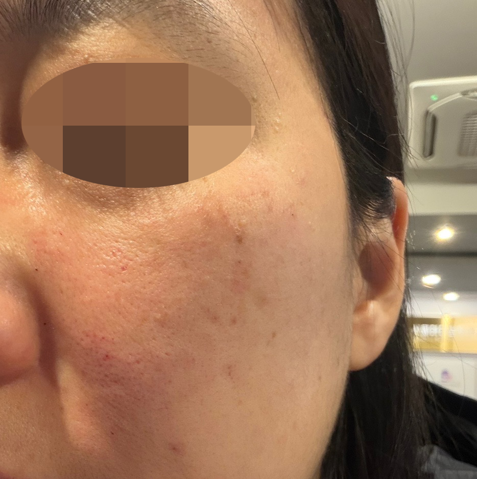 수술후기이미지