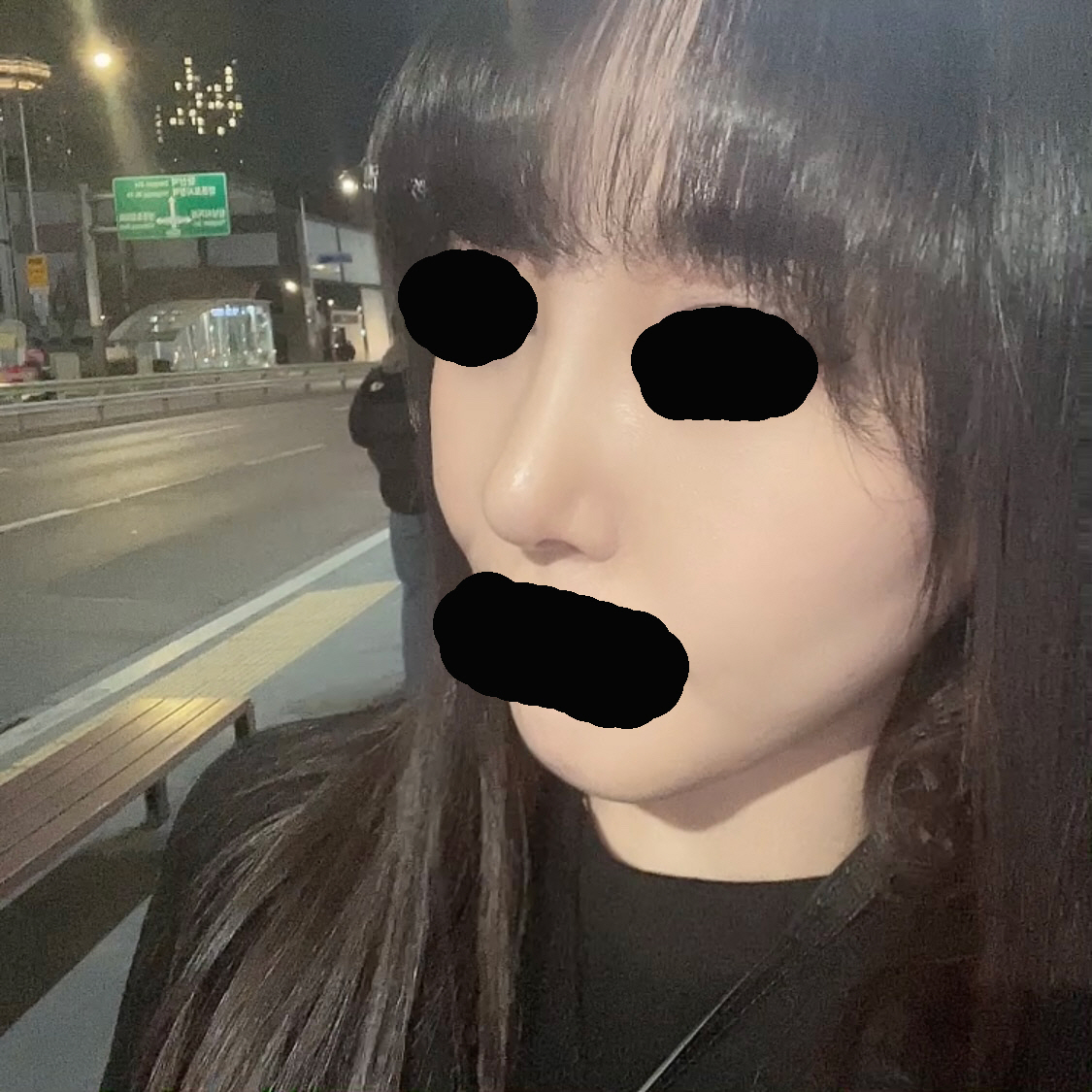 수술후기이미지