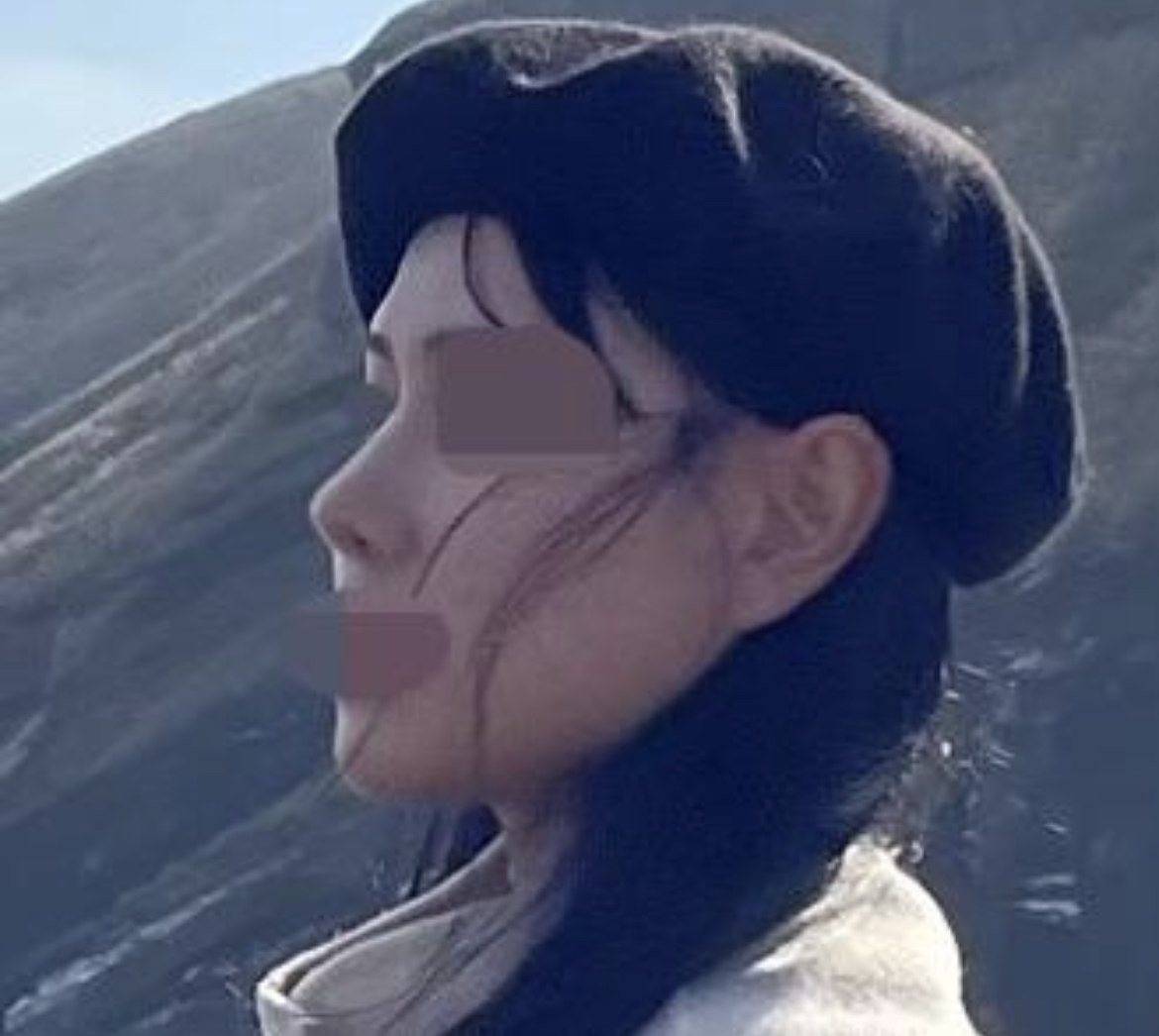 수술후기이미지