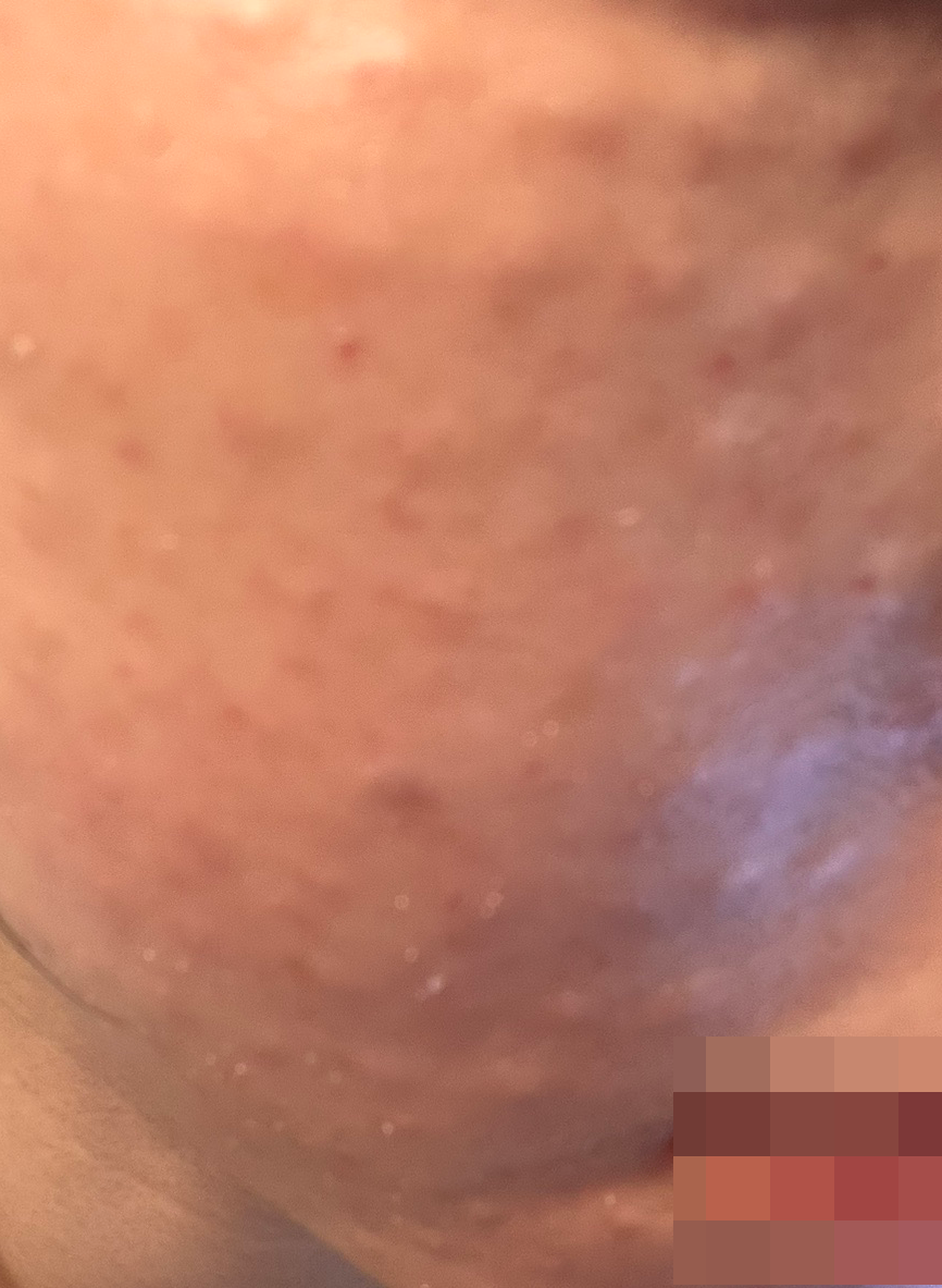 리즈네는 여기서만! 효과부터 응대까지 다 만족이에요~~