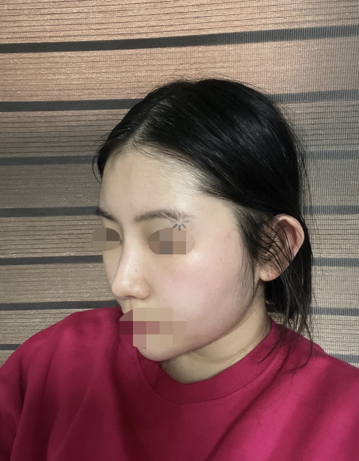 수술후기이미지